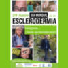 Chipiona visibiliza hoy 29 de junio la enfermedad de la Esclerodermia